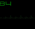 EKG Simulation Screenshot 0