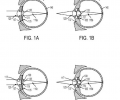 Google Plans To Implant Android Into Your Eye Google Plans To Implant Android Into Your Eye